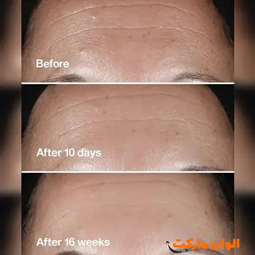 Buy-anti-wrinkle-serum-face-model-smart-clinique-clinique-repair-clinique-model-s031