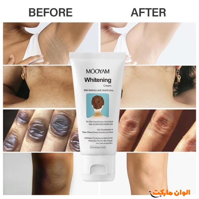 Buy-whitener-for-the-back-of-the-neck-and-sensitive-spots-of-hair-code-r059