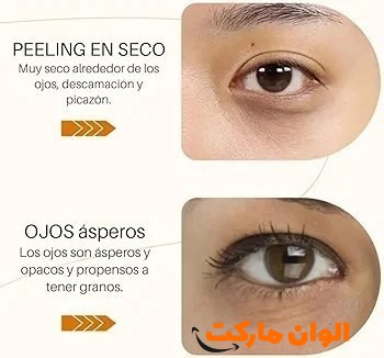 خرید پچ زیر چشم برنج بیواکوا تک و عمده r033