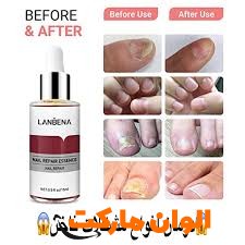 خرید سرم ترمیم و تقویت ناخن لانبنا (LANBENA Original) کد R046