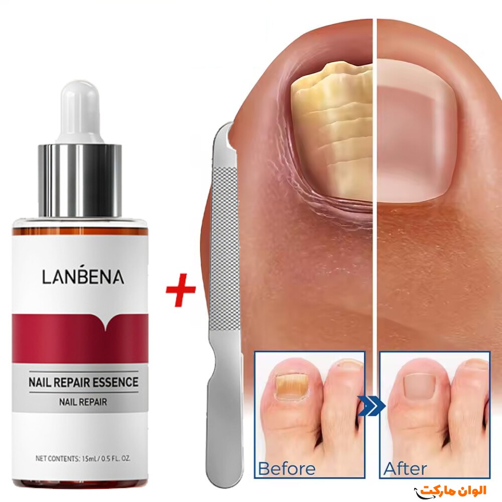 خرید سرم ترمیم و تقویت ناخن لانبنا (LANBENA Original) کد R046