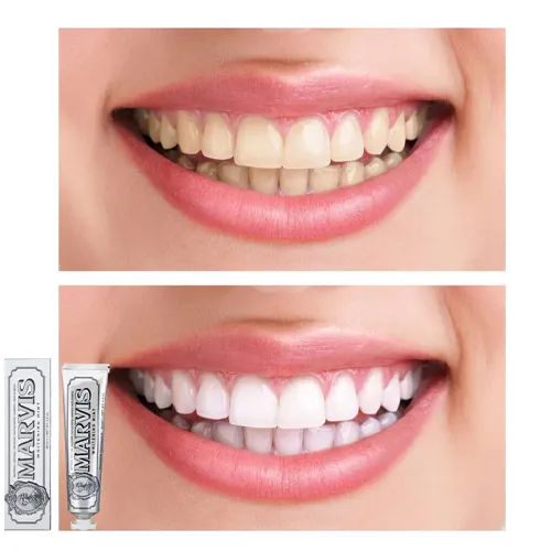 Toothpaste-new-model-code-g4998