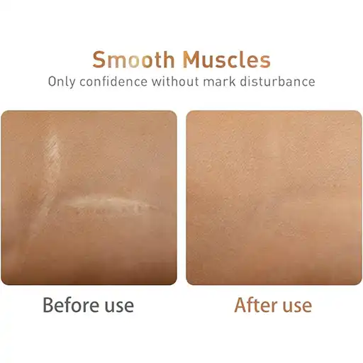 Lanbna Scar Repair Serum