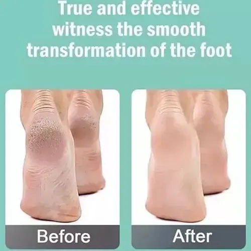 پخش-سنگ-پا-و-سوهان-مدل-جدید-کد-g5737