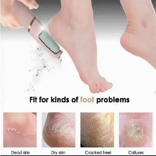 پخش-سنگ-پا-و-سوهان-مدل-جدید-کد-g5737