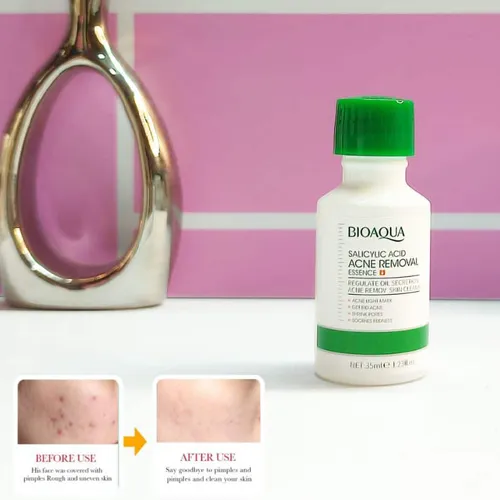 سرم-ضدجوش-مدل-جدید-کد-g6845