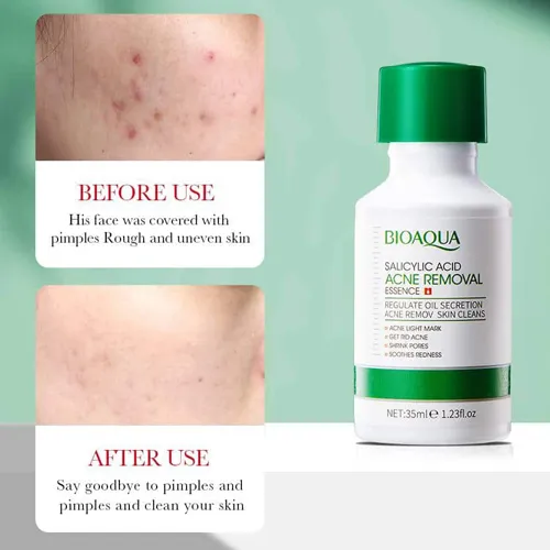 پخش-سرم-ضدجوش-مدل-جدید-کد-g6846