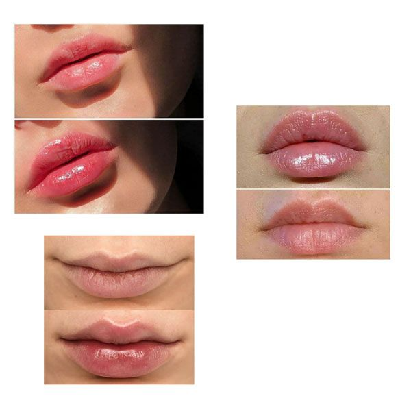 خرید-حجم‌-دهنده-لب-کیس-بیوتی-کد-z3767