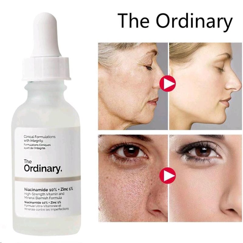 The ordinery اوردینری-سرم-نیاسینامید-اسید