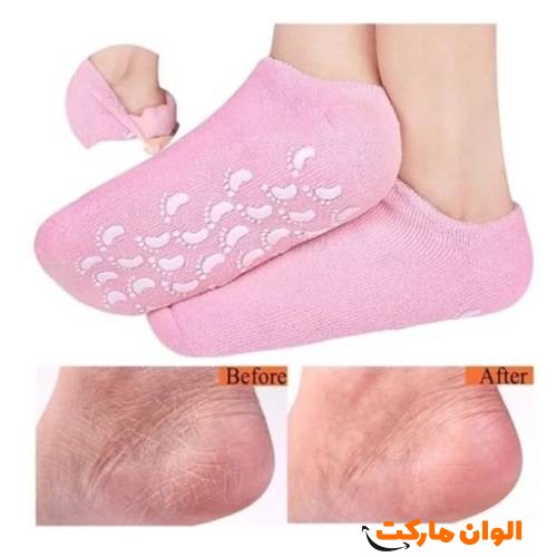 جوراب سیلیکونی رفع ترک و خشکی پوست